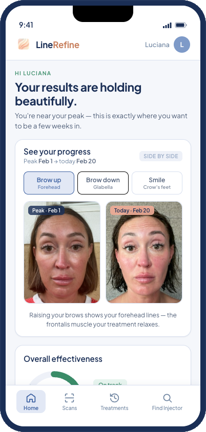 LineRefine app comparing a patient's peak results against today, side by side